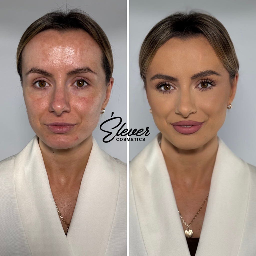 Black Friday Sale - Supreme Skin